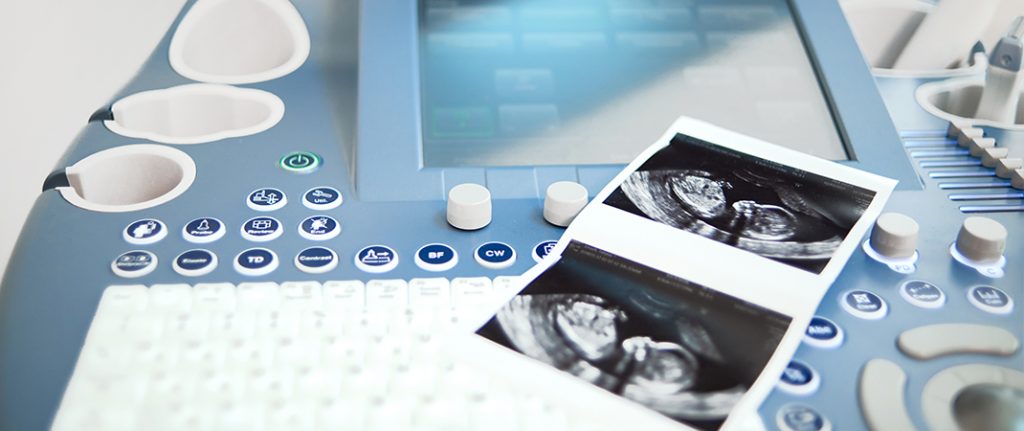Tekrarlayan Gebelik Kayıpları